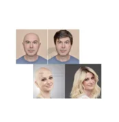Mono Base hair,USA Super Hair,USA Superior Hair, USA Dura Hair,H1 Hair,Ultra H1 Hair,Los Angeles Hair,USA Apollo Hair,Hair Extensions,wwwpakistanhairwigscom,ultra thin hair,full pu Base hair, French lace hair, American Hair,Chinese Hair,Hair World Hair, Hair World Hair,Hong Kong Natural Hair,Hair Replacement Center in Rawalpindi,Hair Wigs Seller,UK Base Hair System,Silk Base Hair, Golden Silk Hair, Korean Front Lace,Korean Swiss Hair, EKO Hair System, Hair Wigs in Pakistan,Hair Sellers in Pakistan, Hair Invision,Hair Club, Capital Hair Club, Invision Hair,Suman Hair, Summan Hair,Suman hair, QS Hair, hehecom,Hair Lounge Lahore,Prime Hair Club,ilyas hair,elyaz hair,hair collection,prime hair club,prime club,lahore hair wigs,karachi hair wigs, Peshawar hair wigs, Islamabad hair wigs, Rawalpindi hair wigs,kashmir hair wigs, Gujranwala hair, Gujranwala Hair Club, Sialkot Hair Club,Karachi Hair Club,Hair Art Salon,The Hair Doctors,New Fashion Icon Hair,Anaya Hair Wigs, Groomer Hair Point,Nasir Hair Wigs,CosmeSurge Hair, Royal International Hair,Skin Esthetic Clinic, Saad Hair Club,Wig Center,Glamorous Hair Wigs Islamabad,Halo Hair,Prime Club For Beauty, Care Collection,QS Enterprise,MN Traders Lahore, Nasir Hair Wigs, New Hair Image Lahore,Dynamiclinic, Royal Cosmetic Surgery, SKN Cosmetics,fue hair Islamabad, Invision hair,hairtransplantpk, international laser hair transplant,hairworldpk,the hair doctors pk,thehairdoctorspk,hairclubpakistan,Pak Hair Club, hair club Multan, Hair Skill Multan, Hair Skill Rawalpindi,Hair Skill Islamabad,Hair Skill Lahore, Hair Skill Gujranwala,Hair Fast Rawalpindi, HairSkill,Medixo Hair Wigs Rawalpindi & Islamabad,Hair Plus hair transplant centre,Ajmairy Hair Dressers and Cosmetics Store,Hair Care Studio Rawalpindi,The Hair Loss Clinic,Nagi Hair Saloon,Skinovations Laser, Skin Care and Hair Transplant Clinic Hair PRP Laser Hair Botox Fillers Female Skin Specialist,JJ Aesthetics - Hair Transplant, Skin & Plastic Surgery Clinic,Excellence Hair Transplant Center Islamabad,Cosmesurge Hospital,Micropil Hair Transplant & Aesthetics,Royce Hair Clinic,3D Lifestyle Center of Medical Aesthetics,New Doctors Hair Clinic,Dr Shahnaz Center Islamabad,Dr Abdul Khaliq's Hair Transplant Center Islamabad HairnHair,Excellence Hair Transplant,Elixir Hair Transplant,Dr Feroze Clear Skin Clinic, Hair Doc, Hair Doctor,Hairline Creation pk,Shahab Medical,Shahab Medical & Hair Transplant Center,Hair Lab Men Salon,Head & Hair,Islamabad Hair Transplant,Vagus Cosmetics Hair Transplant Islamabad,Vagus Cosmetics Hair Transplant Islamabad,Hair Club Islamabad,6D Hair Transplant Clinic Islamabad - Best & Advanced Hair Transplant - FUE & DHI Hair Transpla,Hair Club Islamabad,Kashmir Hair Transplant Clinic Islamabad,Dr Rana Irfan,Hair Transplant,Hair Transplant Islamabad - Hairhub,The Hair Loss Clinic,Dr Nadeem Umar's,Dr Muhammad Salman Khan - Hair Transplant Expert in Islamabad,Hair Fast Islamabad,Medixo Hair Wigs Rawalpindi & Islamabad,Dr Simeen's Skin & Laser Centre,Pindi Touch Hair,Invision Hair Care Centre, Trusted Solution For Hair, Pakistan Hair Wigs Rawalpindi Cantt, FHRC Lalkurrti Rawalpindi,Cosmetic Surgery Studio,Laser Hair Transplant & Cosmetic Centre,Glamorous PRP Therapy Clinic Islamabad - PRP Face & Hair,Natural Hair club Rawalpindi,Royal clinicIslamabad,ARC Rawalpindi,Manis Hair care Non Surgicql replacement center,Hair Transplant Studio,Laser Inn Aesthetic Hair Transplant Islamabad, Dr Nasir Rashid,Hair Wigs,Hair Units,Non Surgical Hair,Hair Transplant,Q6 Hair,Swiss Front Hair,Front Lace Hair,Male Wigs,Hair Patches,Frontal Hair Line,MGM Hair,Euronext Hair,USA Base Hair, Swiss Base, Swiss Folded Front,Miraj Hair,Australia Hair,Icon Hair,Top Priority Bond, Wig Fixing Bond, Wig Glue, Wig Bond,Hair Unit Bond,Hair Unit Glue,HNH60, SP40,Super Hold,Walker Glues,Walker Tapes, Hair Shiner, Wig Shiner, Hair Unit Shiner,Top Priority Bond,HNH60 Bond,Hard Bond,Wig Fixing Bond,SP40 Bond, Super Hold Bond, Walker Bond, Walker Glue, Ghost Bond, Ultra Hold Bond, Ultra Hold Tape,NoShine Tape,Wig Tapes,German Tape,Pink Tape,Lace Front Tape,Hair Units,Hair Wigs,Hair Systems,Top Priority Bond, Wig Fixing Bond, Wig Glue, Wig Bond,Hair Unit Bond,Hair Unit Glue,HNH60, SP40,Super Hold,Walker Glues,Walker Tapes, Ultra Hold Glue, Walker's Ultra Hold Glue,German Tape,German Wig Tape,Yellow Wig Tape, German Brown Tape,German Cloth Tape,German Net Tape, Hair Wig Tape,Hair Extension Tape,Walker Tapes, Hair Unit Tape, Red Tape, Sensi Tak Tape,Pink Tape, Wig Double Tape,Extenda Bond Tape,Airflex tape,German Tape,German Wig Tape,Yellow Wig Tape, German Brown Tape,German Cloth Tape,German Net Tape, Hair Wig Tape,Hair Extension Tape,Walker Tapes, Hair Unit Tape, Red Tape, Sensi Tak Tape,Pink Tape, Wig Double Tape,Pink Tape Strips,German Tape,German Wig Tape,Yellow Wig Tape, German Brown Tape,German Cloth Tape,German Net Tape, Hair Wig Tape,Hair Extension Tape,Walker Tapes, Hair Unit Tape, Red Tape, Sensi Tak Tape,Pink Tape, Wig Double Tape, NoShine Tape,Wig Repairing,Lace Repairing,Wig Border Repairing, hair wig repairing, hair unit repairing, hair system repairing,hair patch repairing, hair repairing, wig repairing,wig cap repairing, Wig Clips,Hair Wig Clips,hair dryer,Hair Shiner,Hair Wig Shiner,Wig Shiner,Shiner Spray,Hair Shiner,LeaveinCinditioner,Leave-in-conditioner,hair keratin,Keratin Conditioner,C22 Solvent,c22 cleaner,c22 remover,wig Cleaner,wig remover,scalp protector,Sensi Tak Tape, Wig Tape, Red Tape, Pink Tape, ultra hold tape, noshine tape,no-shine tape,german wig tape, german Brown tape, easy green tape, superstick tape, super stick tape, lace front tape, LaceFront tape, hair wig tape, wig fixing tape,Hair Shiner, Wig Shiner, Hair Wig Shiner, Hair Unit Shiner, Hair System Shiner, Hair Extension Shiner, Yardlie Hair Shiner, Hair Serum, Hair Syrum, Wig Toupee Shiner,Wig Clips,Hair Wig Clips,hair dryer,Hair Shiner,Hair Wig Shiner,Wig Shiner,Shiner Spray,Hair Shiner,LeaveinCinditioner,Leave-in-conditioner,hair keratin,Keratin Conditioner,C22 Solvent,c22 cleaner,c22 remover,wig Cleaner,wig remover,scalp protect,Crown Hair Wig Tape, Crown Super Strong Tape, Double Tape For Hair Wig,Wig Tape,Pakistan Hair Wigs,pakistanhairwigs,C22 Solvent,Ultra Hold Tape,Top Priority Bond,Hard Bond,Highgrip tape, HighGrip Glue,hair units,hair system,hair patch, alopecian wig,cancer wig,wig repairing,ultra Hold Glue,ultra hold tape,hair wig tape, synthetic hair extensions,HighGrip hard bond,top Priority Bond, HnH60 bond, sp40 Bond, walker glue, walker bond, wig bond,Lace Release, Tape Release, Walker Lace Release, Double Tape Release, Wig Release, Wig Remover, Tape Remover,top priority bond, hnh60 bond, hair wig bond,pakistanhairwigscom,ghost bond,great white bond,ultra hold glue,highgrip glue,wig bond, toupee glue,super hold bond, walker bond,walker top priority bond,walker tapes,walker glues,sp40 bond,hnh61 bond,HighGrip Glue,Ghost Bond, HighGrip Tape,HighGrip Bond,pakistan hair wigs, wwwpakistanhairwigs 03038980079, wwwhairsalonsinpakistancom,Hair Wig Washing Wig Wash, Hair Wig Service, wig service, hair wig cleaning,wig cleaning, wig service, hair unit washing, hair system service, hair unit maintenance,wig maintenance, hair patch washing, hair dummy, wig dummy, dummy head, menniquin
