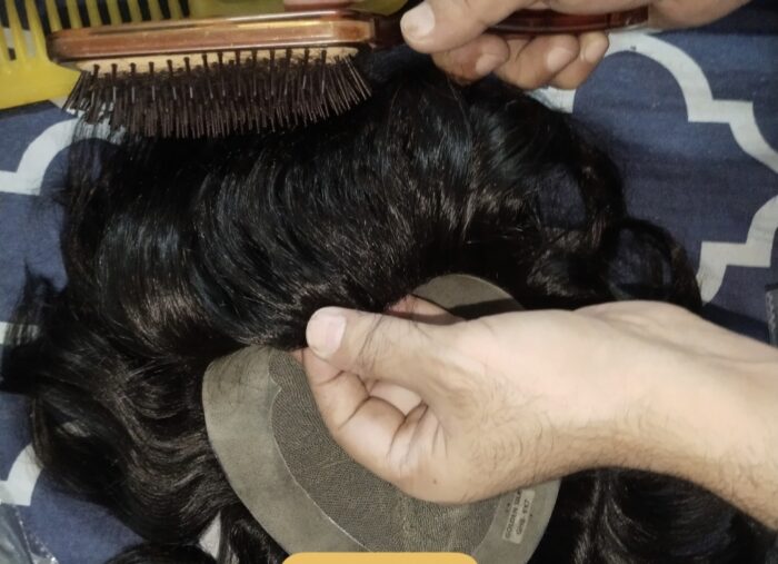 Australia hair patch in Pakistan