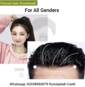 Front Hair Patch Pakistan Natural Hairline