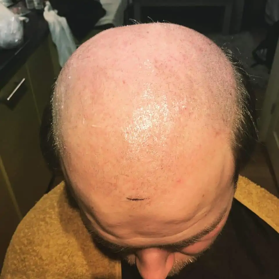 Before Hair wig application