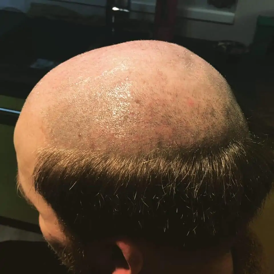 Hair extension for middle sections