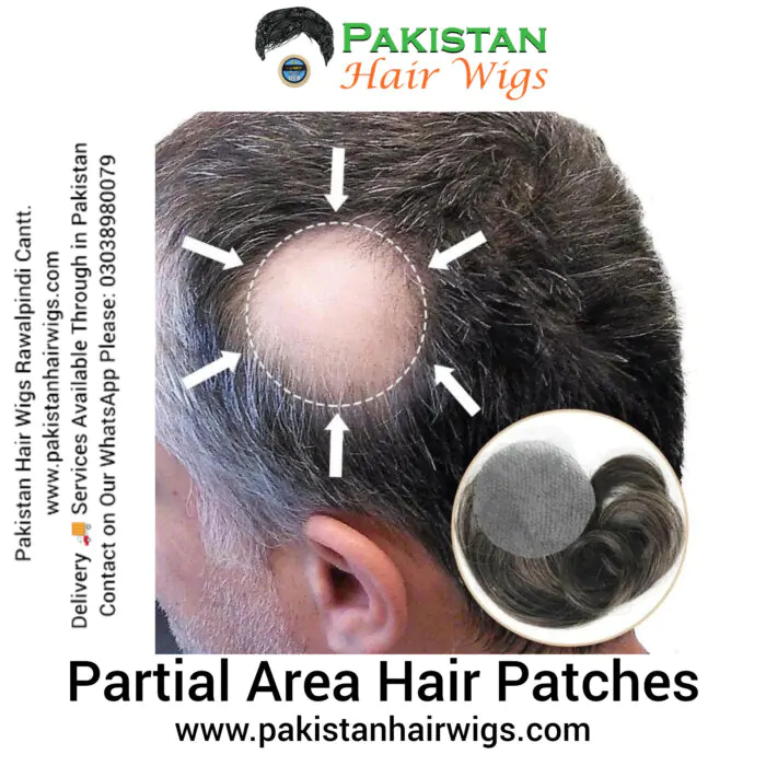 Partial area hair patches for men