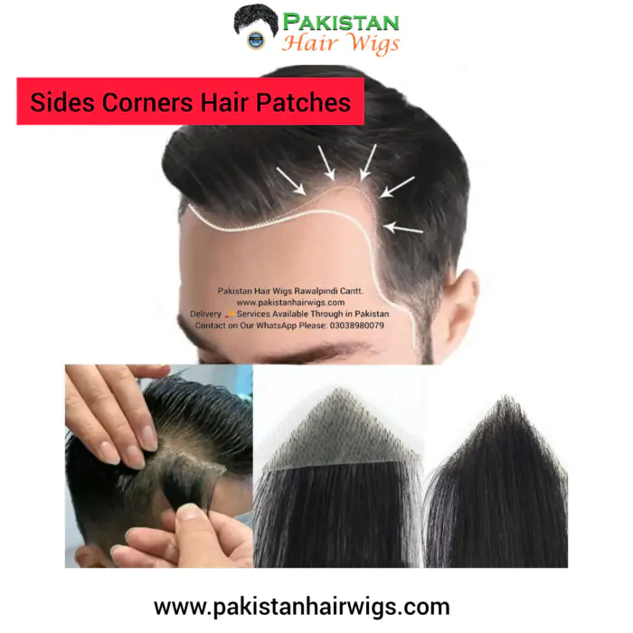 Sides corners hair patch for men