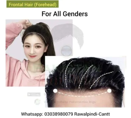 FRONT HAIR LINE Archives Pakistan Hair Wigs