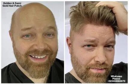 Golden Hair Color & Semi Gold Hair Patch